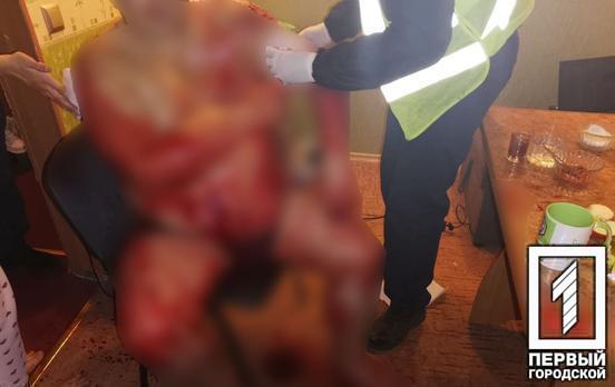 В Кривом Роге мужчину изрезали ножом (фото 18+)